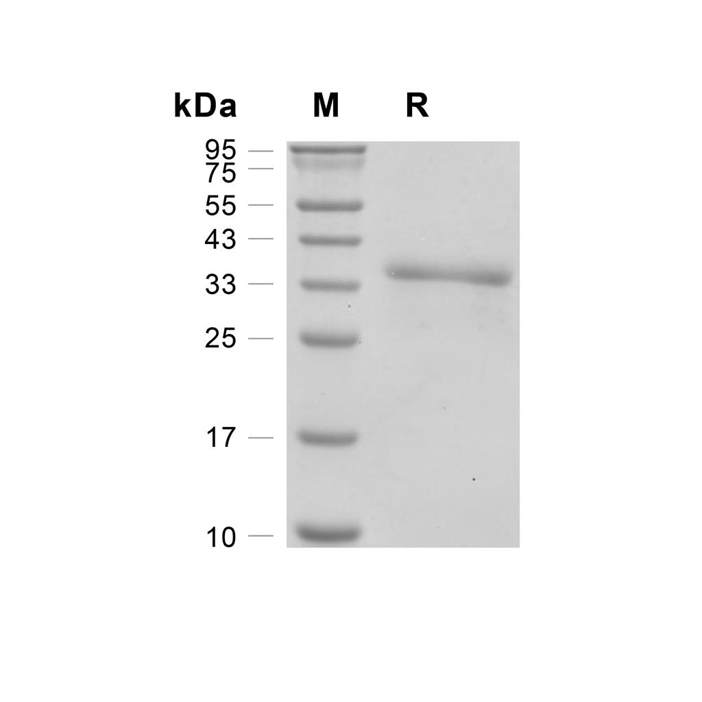 Janus kinase 2/JAK2蛋白, Human (His)
