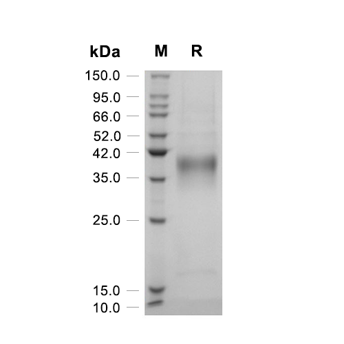 CD158d/KIR2DL4蛋白, Human (HEK293, His)