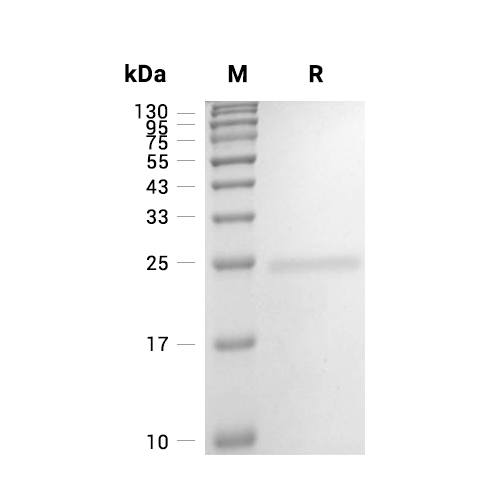 Tetranectin/CLEC3B蛋白, Human (181a.a, HEK293, His)