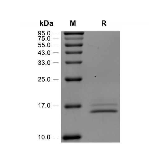 Cystatin C/CST3蛋白, Human (HEK293, His)