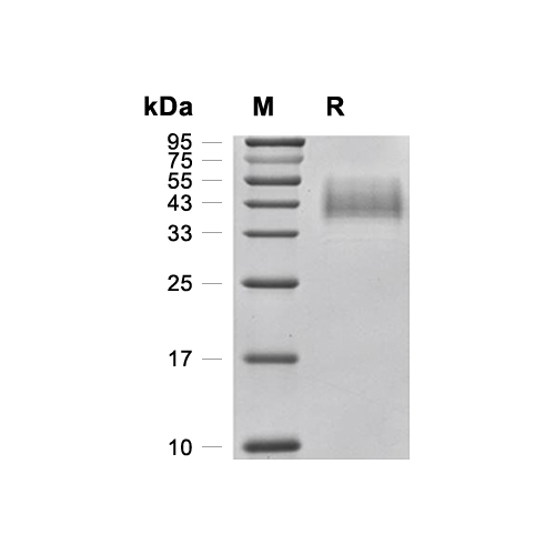 TROP-2蛋白, Human (248a.a, HEK293, His)