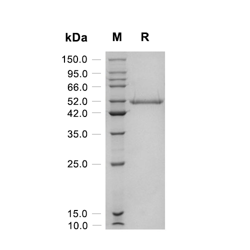 CD4蛋白, Human (365a.a, HEK293, His)