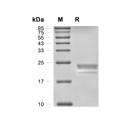 Lipocalin-2/NGAL蛋白, Human (HEK293, His)