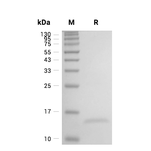 Galectin-1/LGALS1蛋白, Human (His)