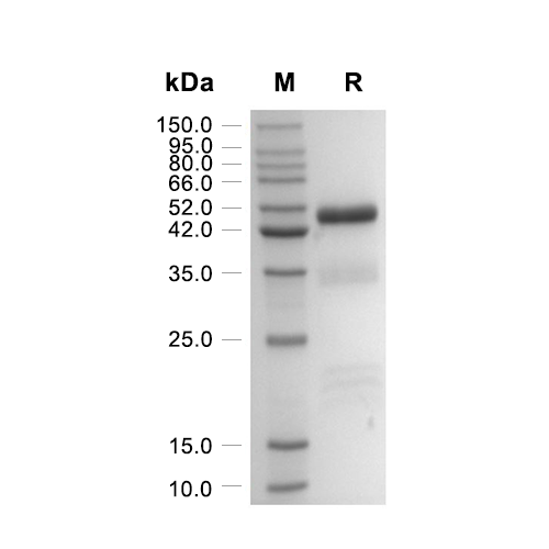 PLAU/uPA蛋白, Human (HEK293, His, solution)