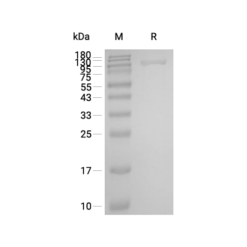 NCAM-1/CD56蛋白, Human (HEK293, His)