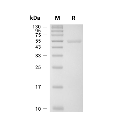 Glutathione synthetase/GSS蛋白, Human (His)