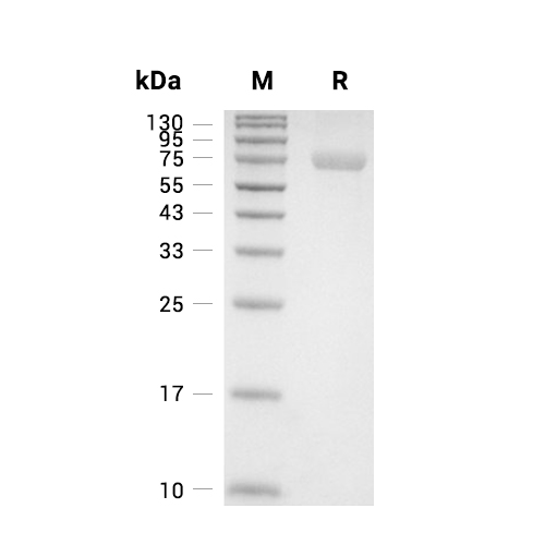 TPP1蛋白, Human (HEK293, His)