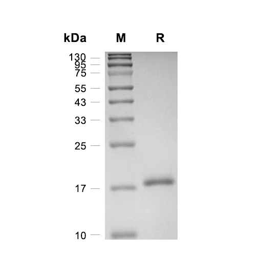 TAC1蛋白, Human (His)