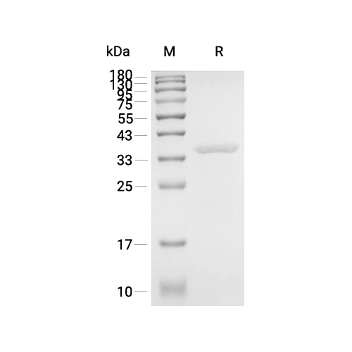 SULT2A1蛋白, Human (His)