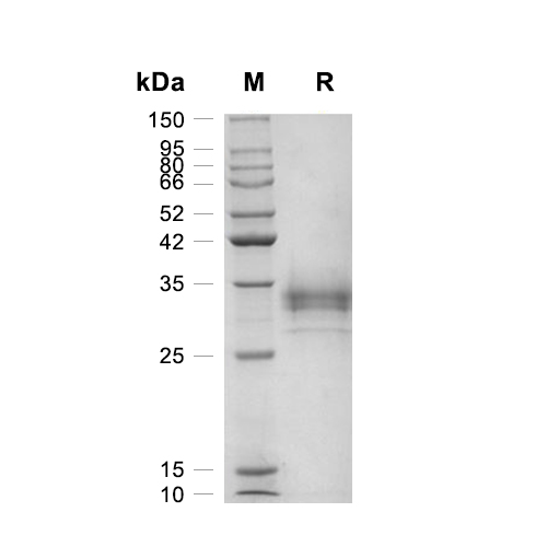 LOX-1/OLR1蛋白, Human (HEK293, His)