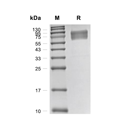 IL-15R alpha蛋白, Mouse (HEK293, hFc)