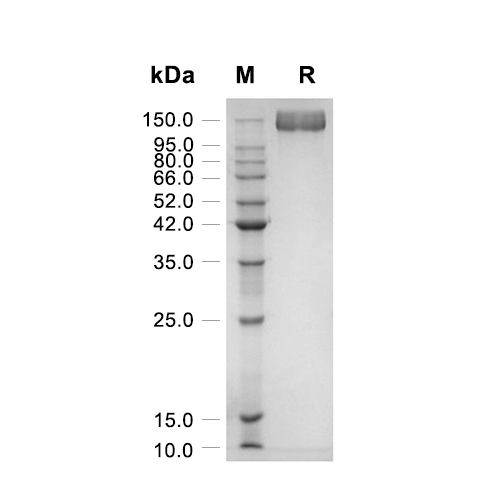 VEGFR-2蛋白, Mouse (HEK293, Fc)