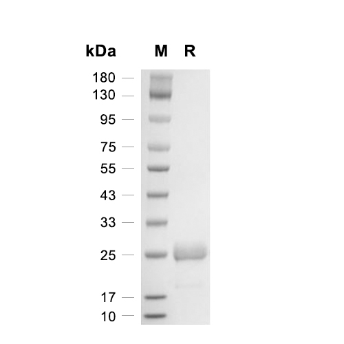 AQP4蛋白, Human (His-SUMO)