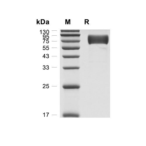 PLXDC2蛋白, Mouse (HEK293, His)
