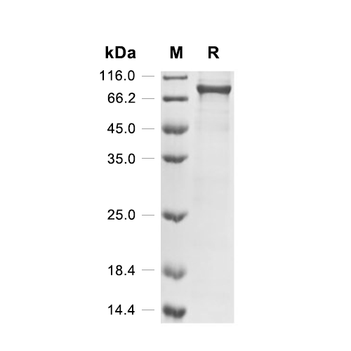 Neurofilament light polypeptide/NEFL, Human (His-SUMO, myc)