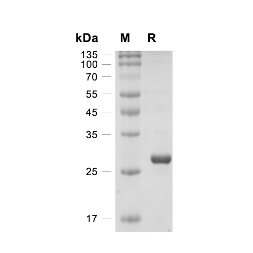 GFP蛋白, Aequorea victoria (His)