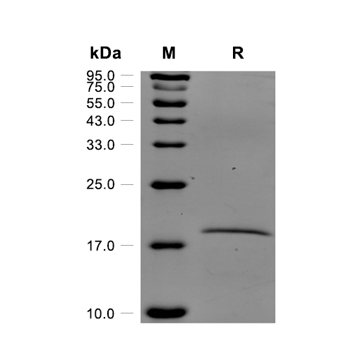 Histone H3蛋白, Human (His)