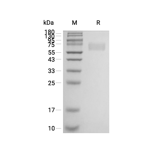 MAdCAM1蛋白, Human (Biotinylated, HEK293, Avi-His)