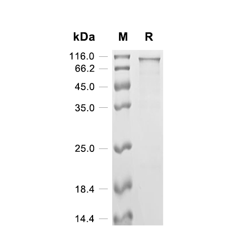 Nucleolar transcription factor 1/UBTF蛋白, Human (His-SUMO)