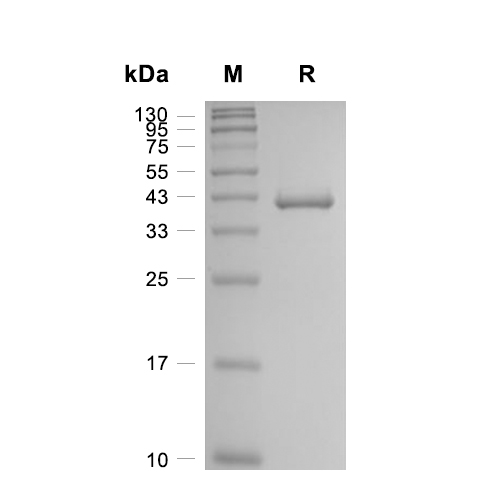 KYAT1蛋白, Human (His)