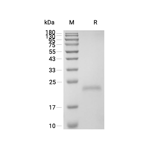 RANK/TNFRSF11A蛋白, Human (His)