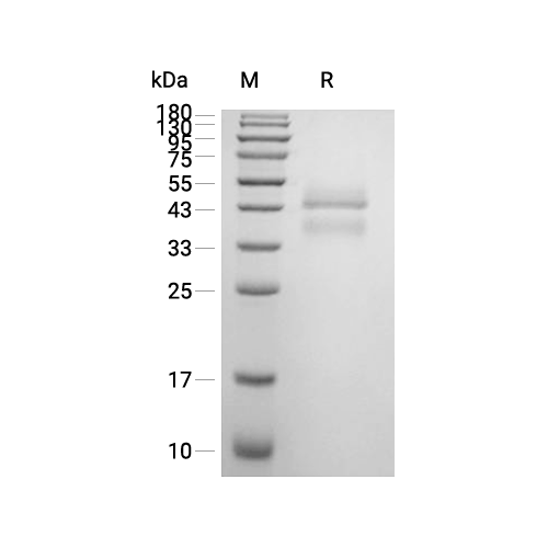 GMP IL-12蛋白, Human (HEK293, His)