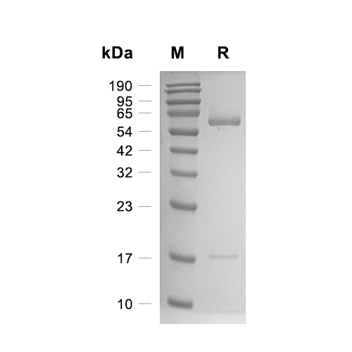 PCSK9蛋白, Rat (HEK293, His)