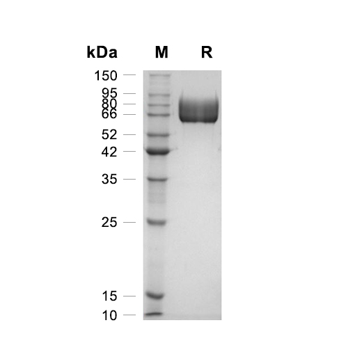 PD-L1蛋白, Rat (HEK293, Fc)