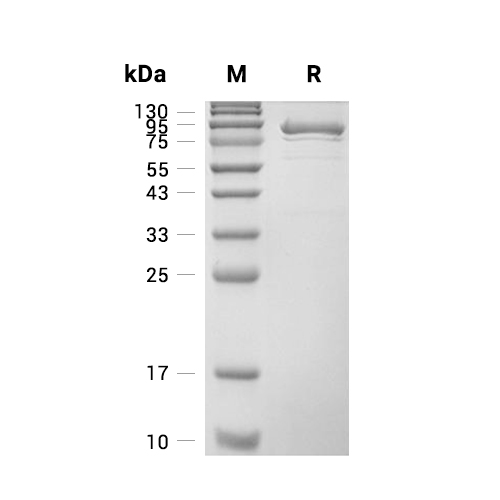 YES1蛋白, Human (sf9, His-GST)