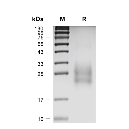 NKG2D/CD314蛋白, Mouse (HEK293, His)
