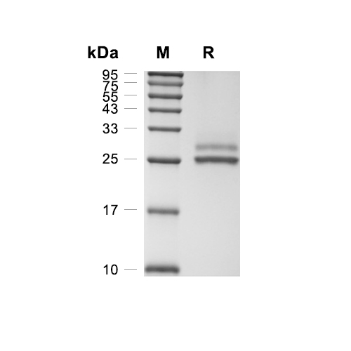 JAM-A/CD321蛋白, Rat (HEK293, His)