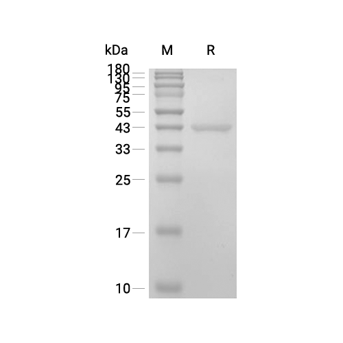 RAC1蛋白, Human (sf9, GST)