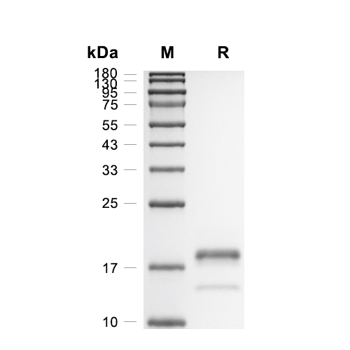 MPZL3蛋白, Human (HEK293, His)