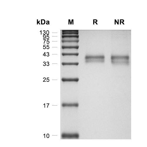 Kallikrein-11蛋白, Mouse (HEK293, His)