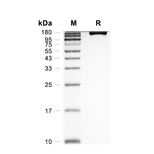 DEC-205/CD205蛋白, Human (HEK293, His)