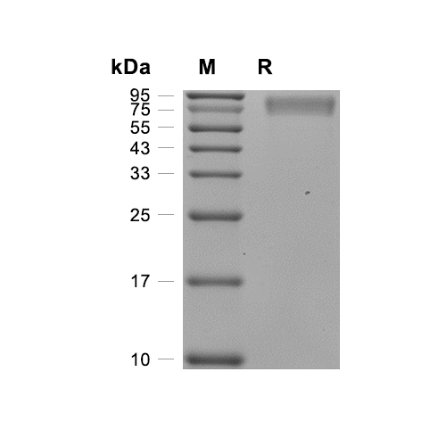 NA/Neuraminidase蛋白, H1N1 (AYV62750, HEK293, His)