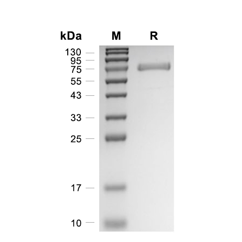 GBA/Glucosylceramidase蛋白, Human (HEK293, His)
