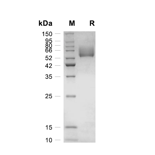 CD98蛋白, Human (HEK293, His)