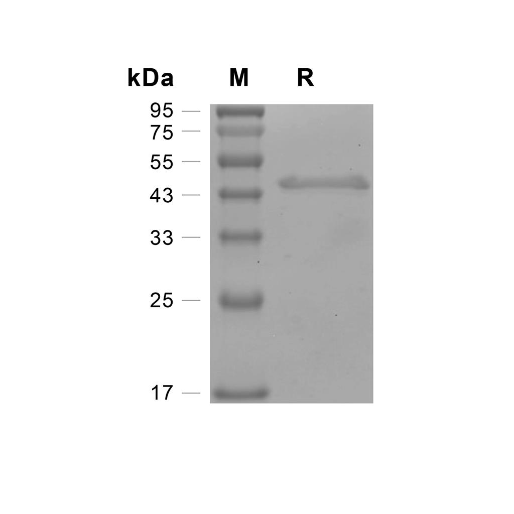 Creatine kinase M-type/CKM蛋白, Human (His)