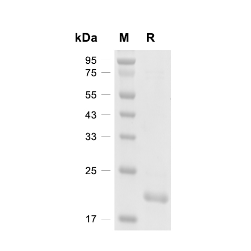 Centrin-2蛋白, Human (His)