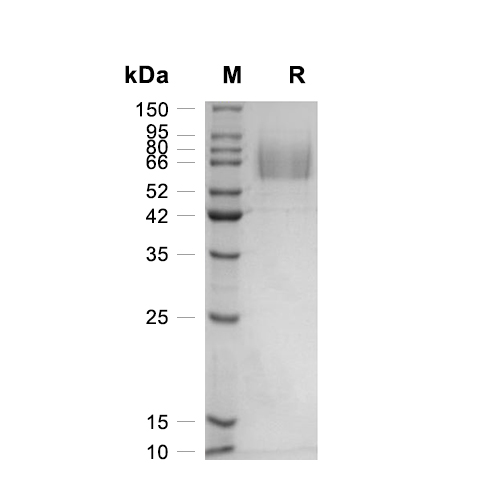 CD97蛋白, Human (HEK293, His)