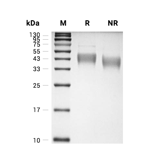 ATP1B1蛋白, Human (HEK293, His)