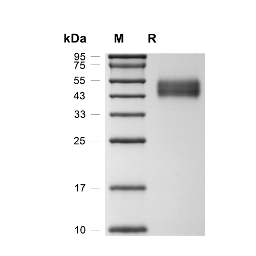 Kilon/NEGR1蛋白, Mouse (HEK293, His)