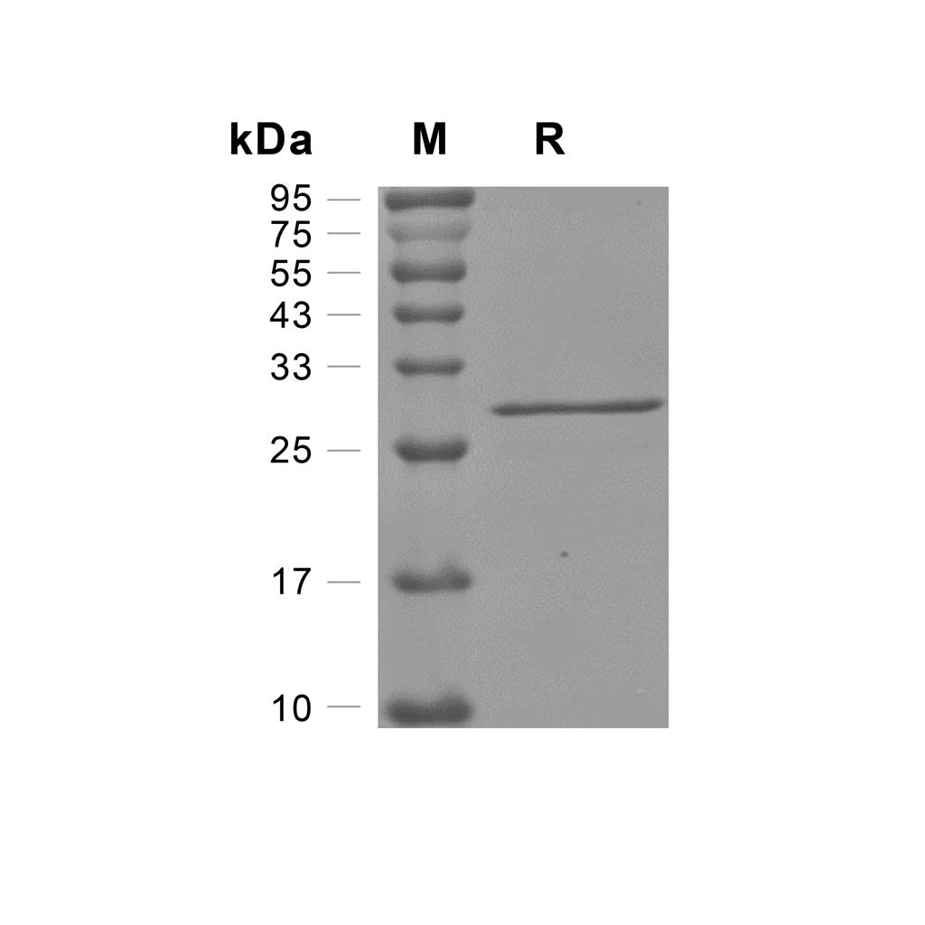 PHOSPHO1蛋白, Human (His)