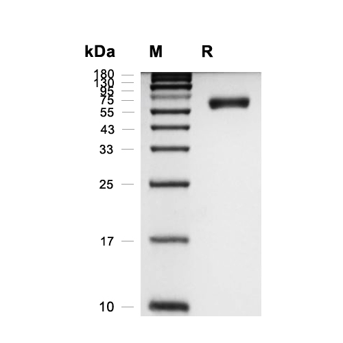 ENPP-7蛋白, Mouse (HEK293, His)
