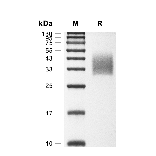 EPCR蛋白, Cynomolgus (HEK293, His)