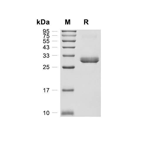 Mast Cell Protease-1/MCPT-1蛋白, Mouse (HEK293, His)
