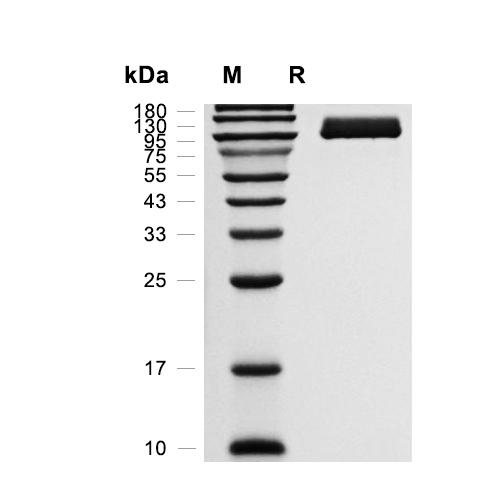 NAALADL1蛋白, Mouse (HEK293, His)