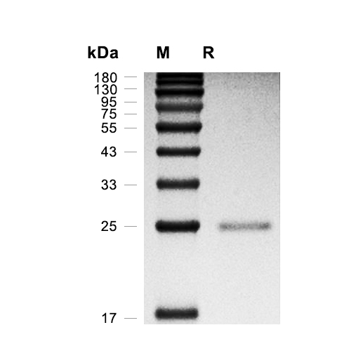 MID1IP1蛋白, Human (His)